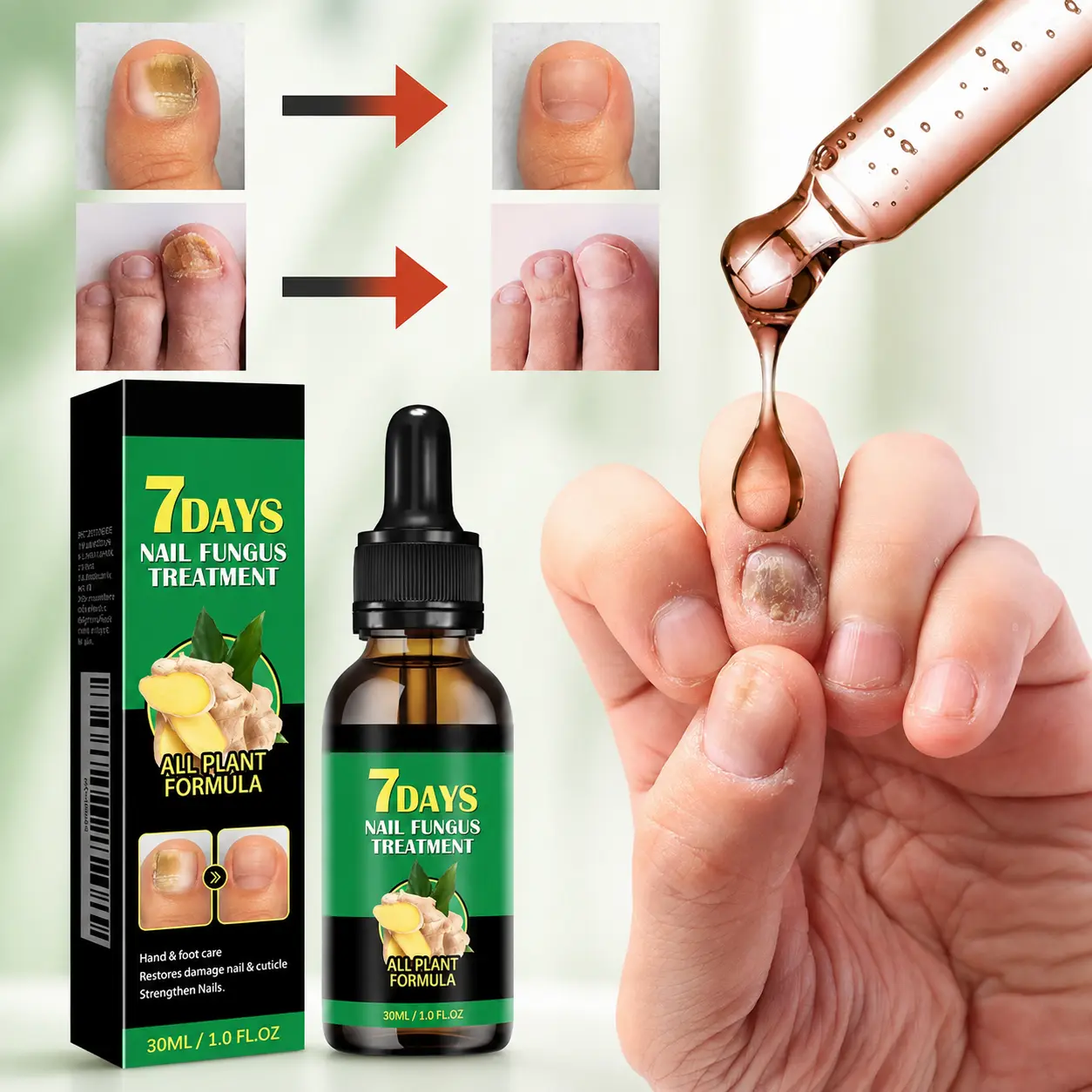 Extra Strength Toenail Fungus Treatment with Undecylenic Acid & Ginger Extract, Antifungal Nail Solution for Thick, Brittle & Discolored Nails, Fast-Acting Nail Repair, Vegan & Cruelty-Free