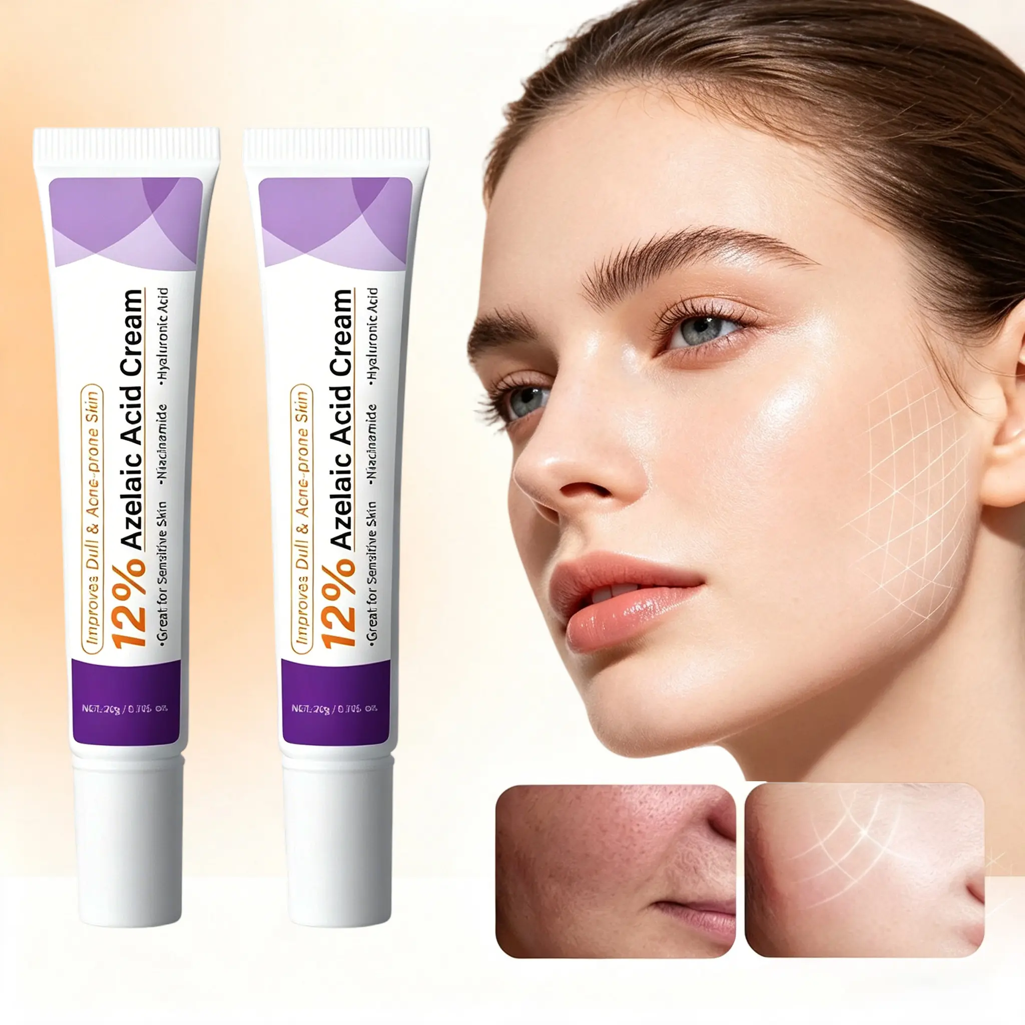 2PCS 12% Azelaic Acid Face Moisturizer , Gentle Moisturizing, Improves Facial Acne, Hydrating, Mild Ingredients, Suitable for Sensitive and Acne-Prone Skin for All Skin Types