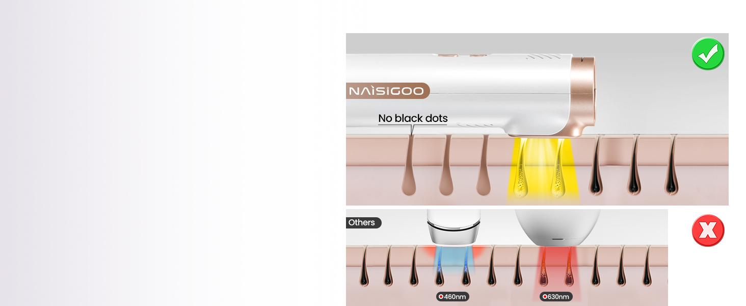 Laser Hair Removal Ice Cooling, Painless IPL Laser Hair Removal Device At-Home Permanent ipl device Portable IPL Smooth Comfort IPL Hair hair remival