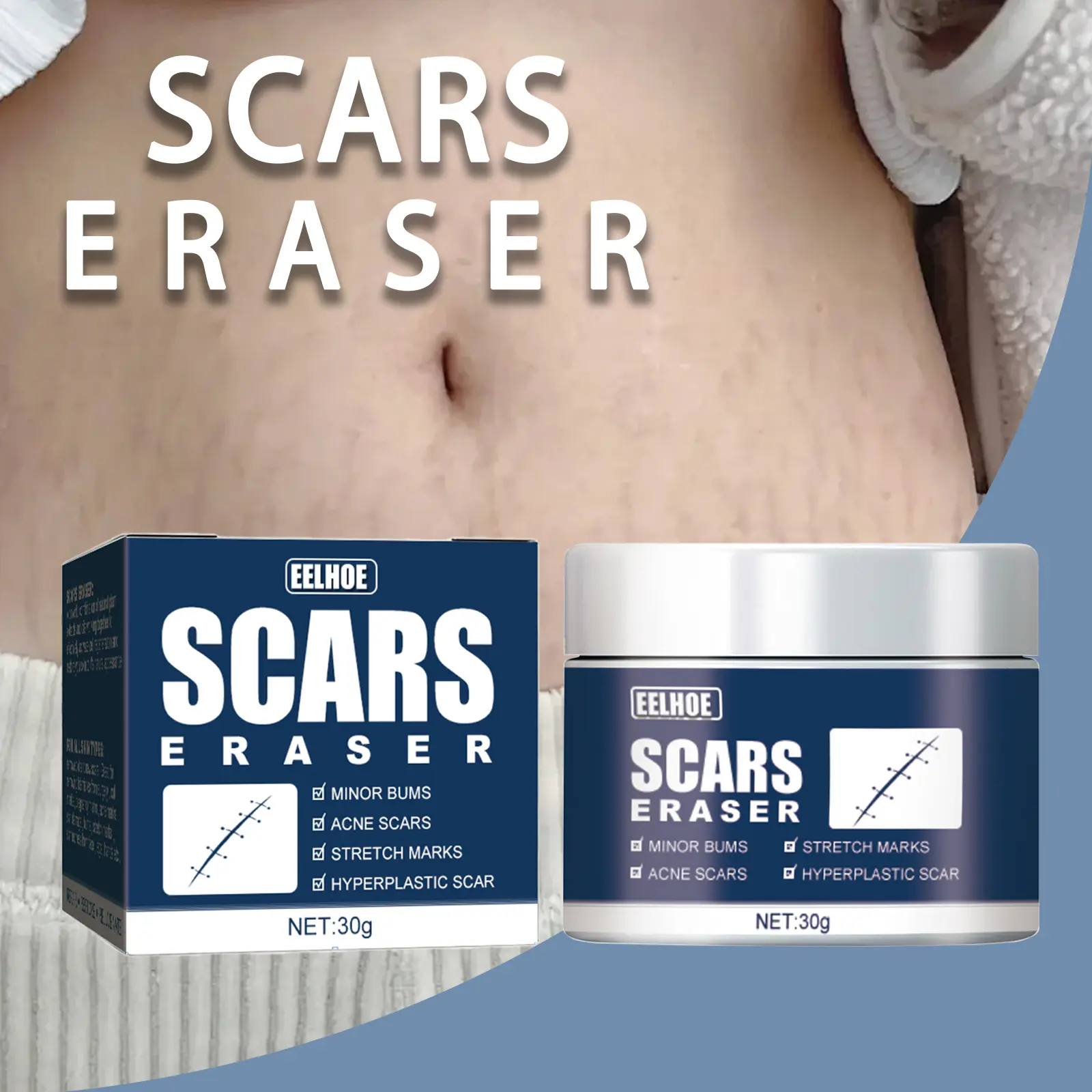 Scar Removal Cream 30g | Advanced Scar Repair For Acne Scars, Stretch Marks, Burn Scars & Keloids | Hydrating Skin Care Formula for Face & Body | Smooth & Even Skin Tone Healthcare Therapeutic Treatment