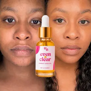 Even and Clear Oil Radiant Moisture Nourishing Carrot Rejuvenating Skincare Serums Calming