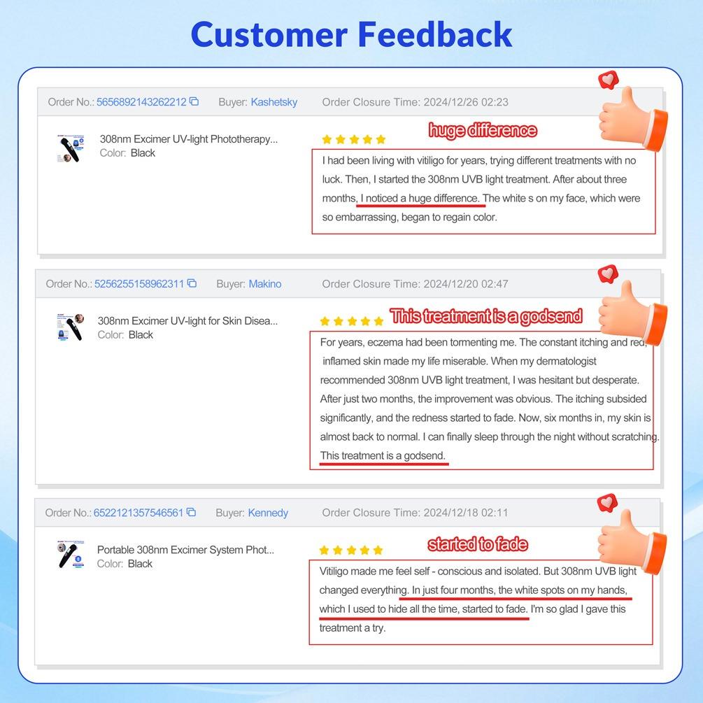 ZJZK 9 Diodes 308nm UVB Excimer Phototherapy Device, 45mW/cm² High Energy Density, Handheld Blue Light Skin Treatment, Targeted Therapy for Vitiligo, Psoriasis, Eczema, Atopic Dermatitis, Portable Home Use for Skin Disorders