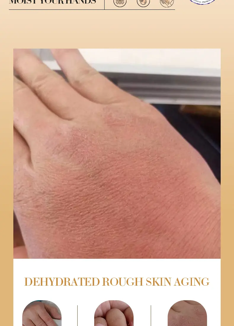 【BUY 1 GET 2 FREE】 Collagen Hand Balm Set, Winter Hand Care for Dry Cracked Hands, Prevents Dryness and Cracking, Moisturizing, Non-Greasy, Easy Absorption, Travel-Friendly, Hand Cream Gift Set