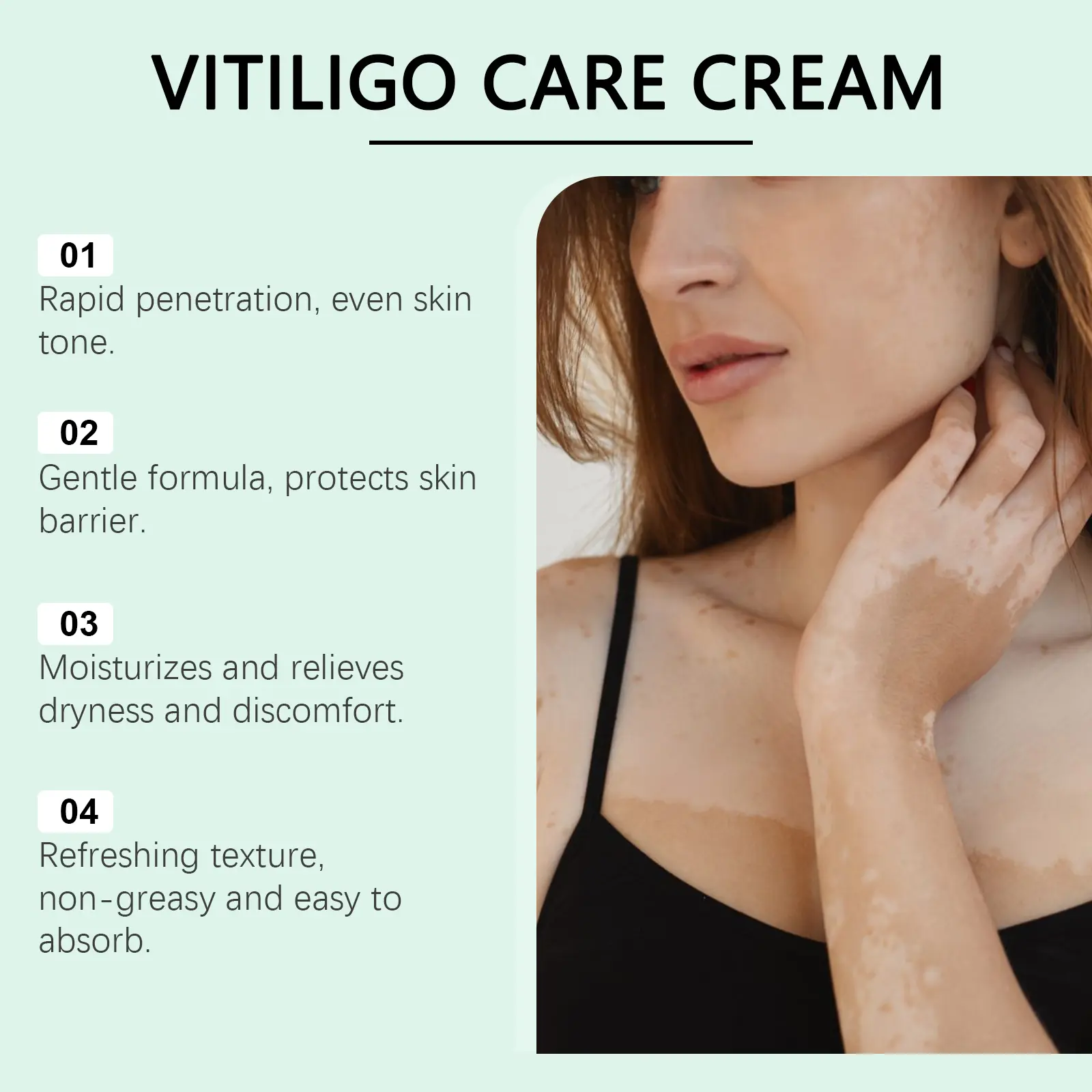 South Moon Vitiligo Care Cream - Mint Leaves & Aloe Vera Extract  Moisturizing Body Skin Repair Cream for Even Skin Tone & Long-Lasting  Moisture - TikTok Shop