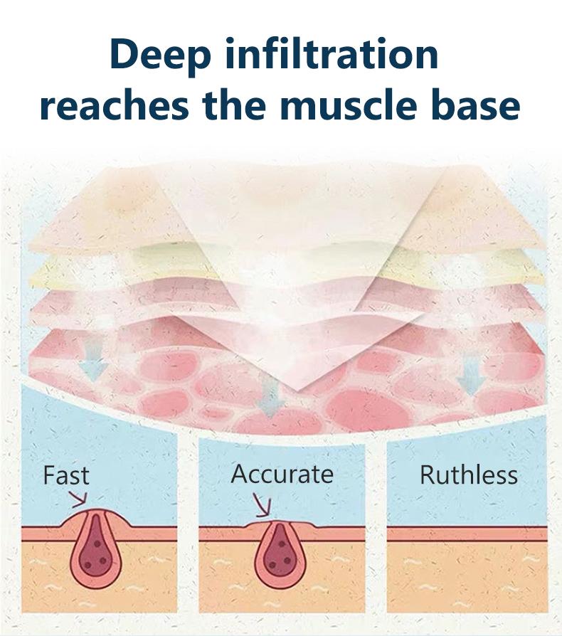 [Compatiple with OPPLII] Salicylic Acid Skin Smoothing Ointment - From  OPPLII - W_A_R_T- Skin Smoothing Ointment, 20g