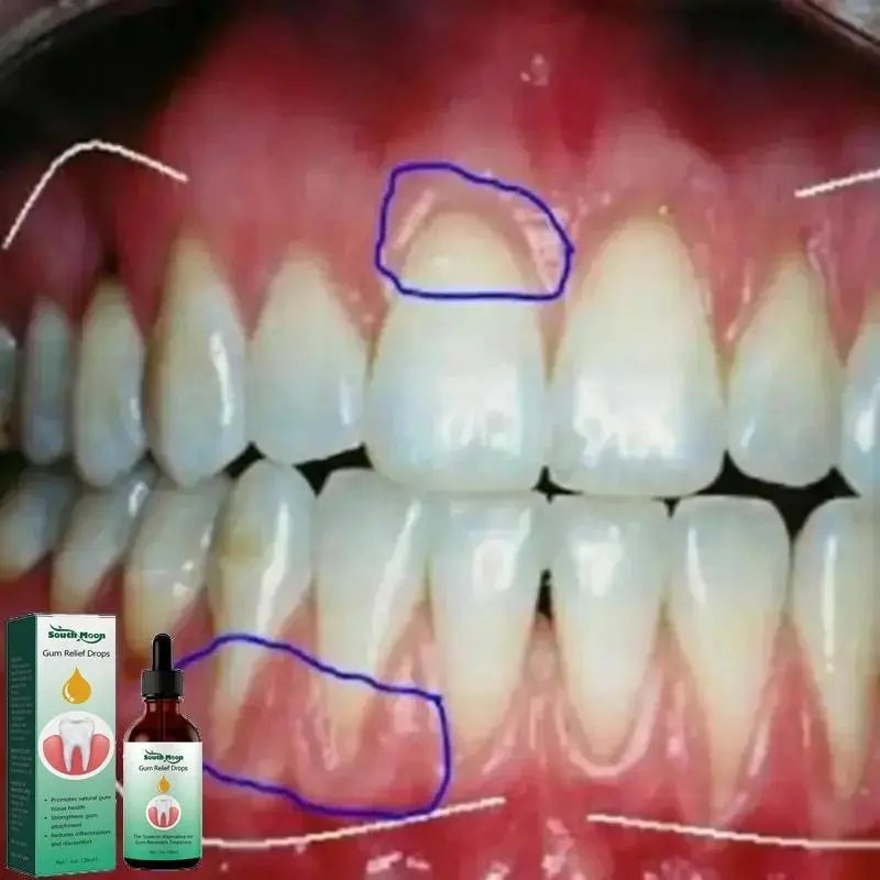 30ml Rapid Cavity Repair Gum Care Drops, Caries, Mousse, Teeth Cleansing, Relieve Gum Decay, Toothache, Plaque, Tooth Stains Oral Cleansing Care Drops