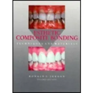 USED-Esthetic Composite Bonding by Ronald E. Jordan DDS  MSC  FICD  FRCD(C) (Hardcover)