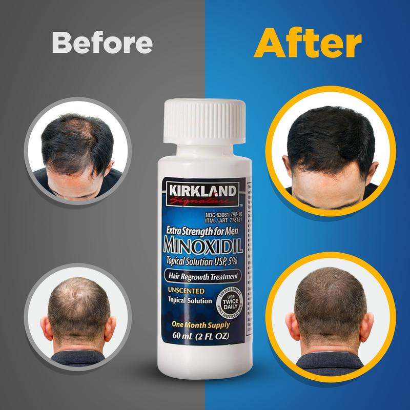 Kirkland Signature Minoxidil 5% Liquid Extra Strength Hair Loss Regrowth Treatment for Men USP Topical Solution with Dropper Included Peppermint Castor Blend Rosemary Biotin Haircare