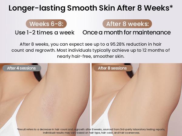 Laser Hair Removal Ice Cooling, Painless IPL Laser Hair Removal Device At-Home Permanent ipl device Portable IPL Smooth Comfort IPL Hair hair remival