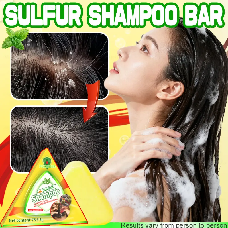 POZOAMIS Sulfur Shampoo Bar for Dandruff & Itchy Scalp Relief, Antibacterial Herbal Cleanser for Oil Control, Foaming Scalp Care for Straight, Wavy & Textured Hair, 75g