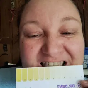 DRDENT Purple Teeth Whitening Strips - 7/21 Whitening Sessions - Safe for Enamel - Non Sensitive Teeth Whitening - Peroxide-Free