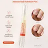 UTOPICK Intense Nail Nutrition Pen – Cuticle & Nail Repair Cream Gel | Hyaluronic Acid, Avocado Oil & Aloe Vera | Watermelon | 5ml