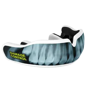 X-Ray Custom Mouthguard