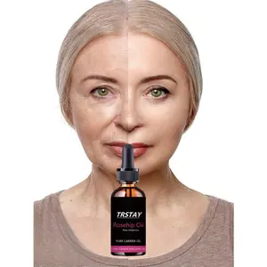 Intensive Repair Night Serum Anti Aging Lifting Treatment Deep Hydration Locking Water To Fill Cells For Soft Elastic Skin Overnight Skin Renewal For Youthful Glow Firming And Moisturizing