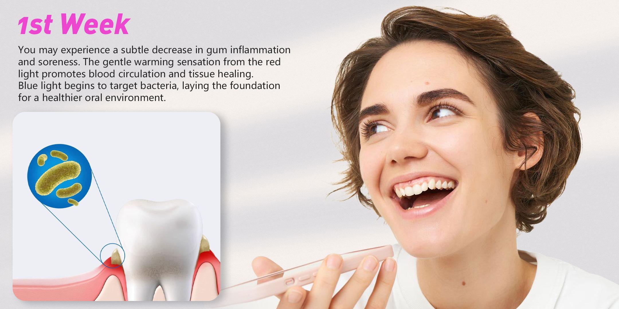 16-Diode Blue & Red Laser Oral Beauty Device for Adults, Teeth Brightener & Oral Brightening Tool, Unscented Daily Mouth Care for Teeth Whitening & Gentle Gum Care, Single Item