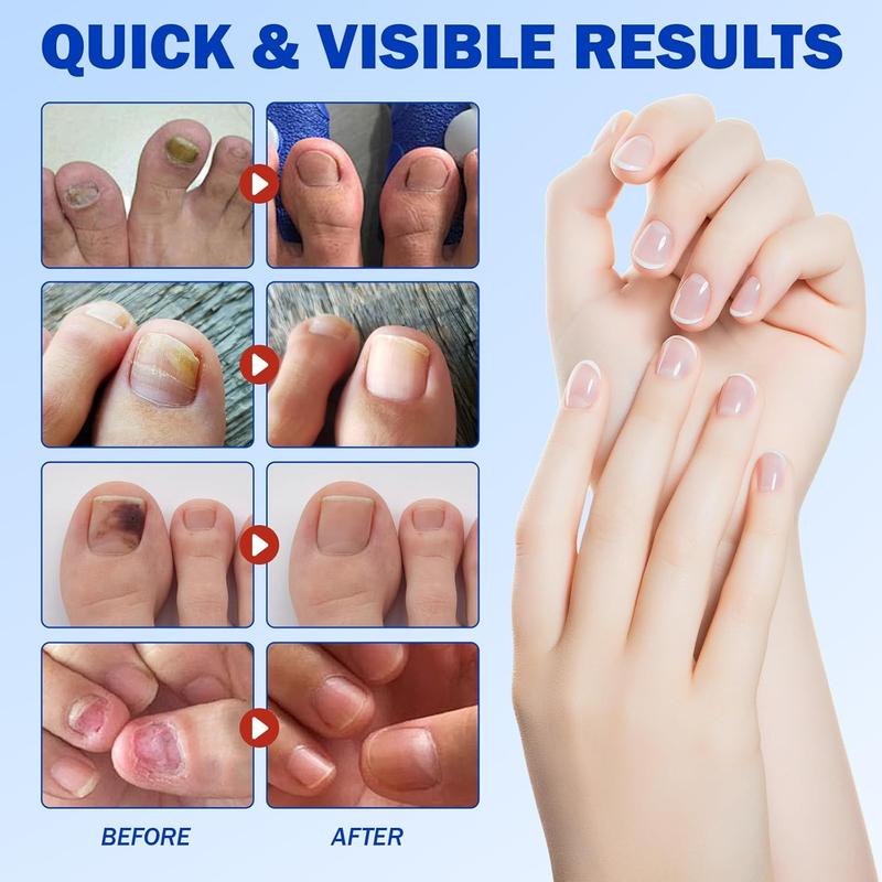 Overnight Nail Recovery Patches – Medical-Grade Hydrogel with Intensive Repair for Weak, Thin or Broken Nails, Effortless Daily Care
