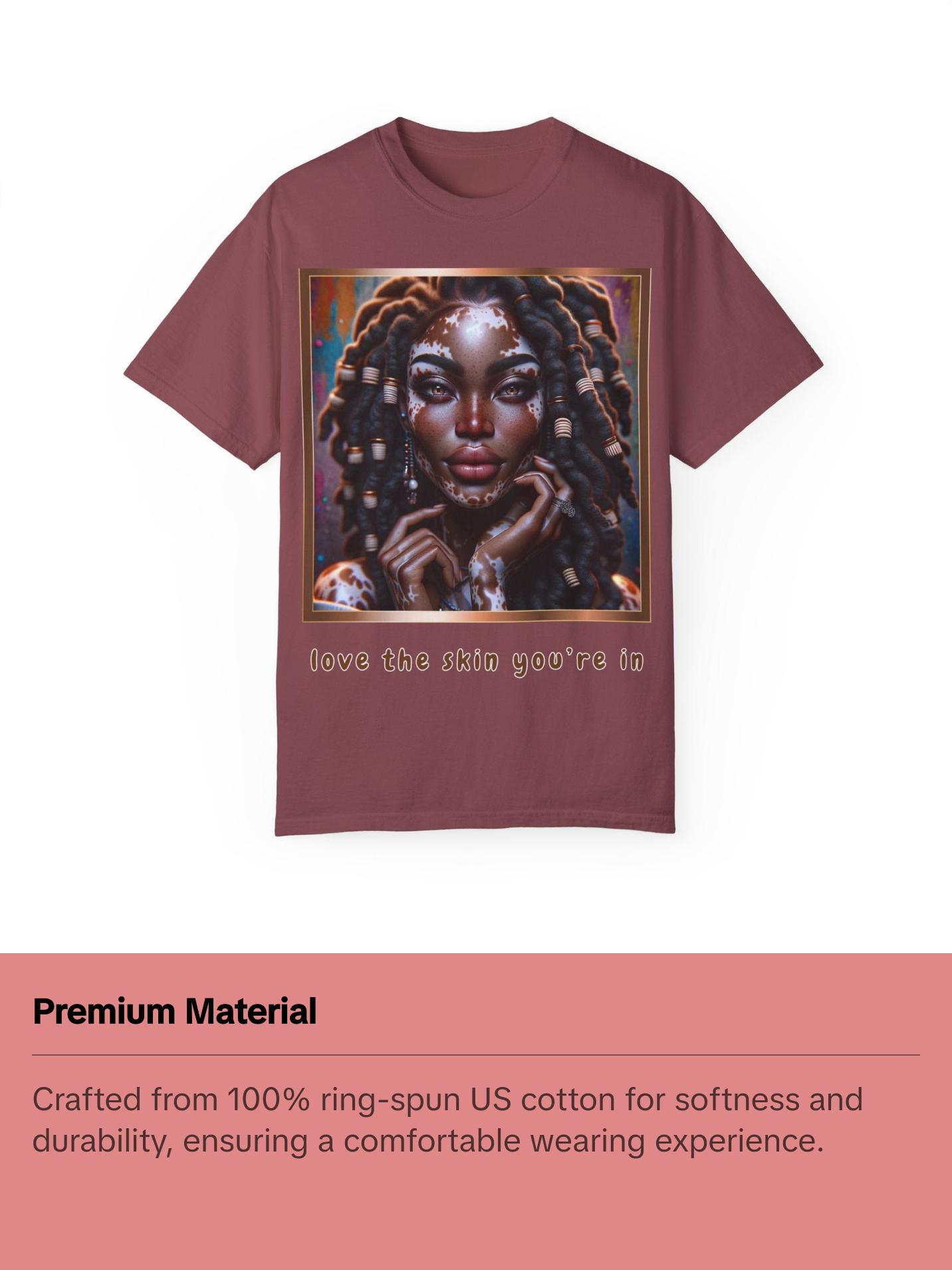 Exquisite Expressions: Celebrating the Unique Beauty of Vitiligo T-Shirt, Love the skin you're in Womenswear Casual Fashion Comfort Streetwear