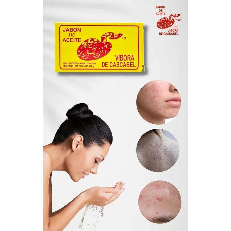 Jabón de Vibora de Cascabel 4.93 oz Rattlesnake Oil Soap for Skin Made in Mexico 140 GR