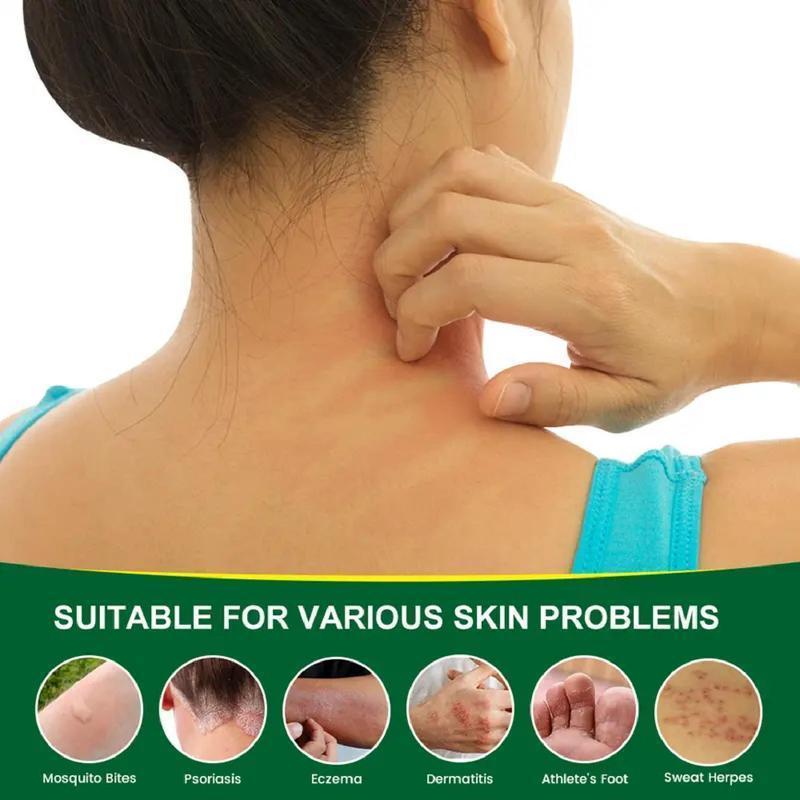 Premium All-Natural Herbal Soothing Cream for Psoriasis, Eczema, Dry & Sensitive Skin Relief | Plant-Based Itch Treatment Balm for Mosquito Bites - 30g