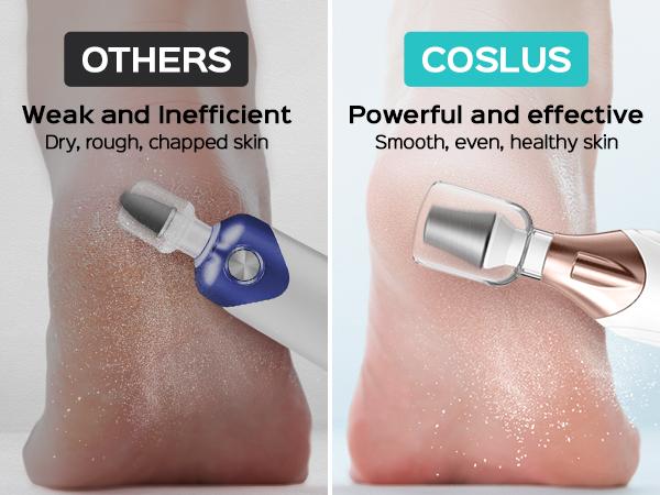 COSLUS Electric Callus Remover: 5-in-1 Multifunctional, Upgraded Sapphire Grinding Wheel, Portable Foot Care Tool, Waterproof Foot Grinder, Rechargeable Foot Care Kit.Effectively Removes Dead Skin,Hard Skin,Dry Calluses,Thick Nails,Stubborn Foot Corns,Diy