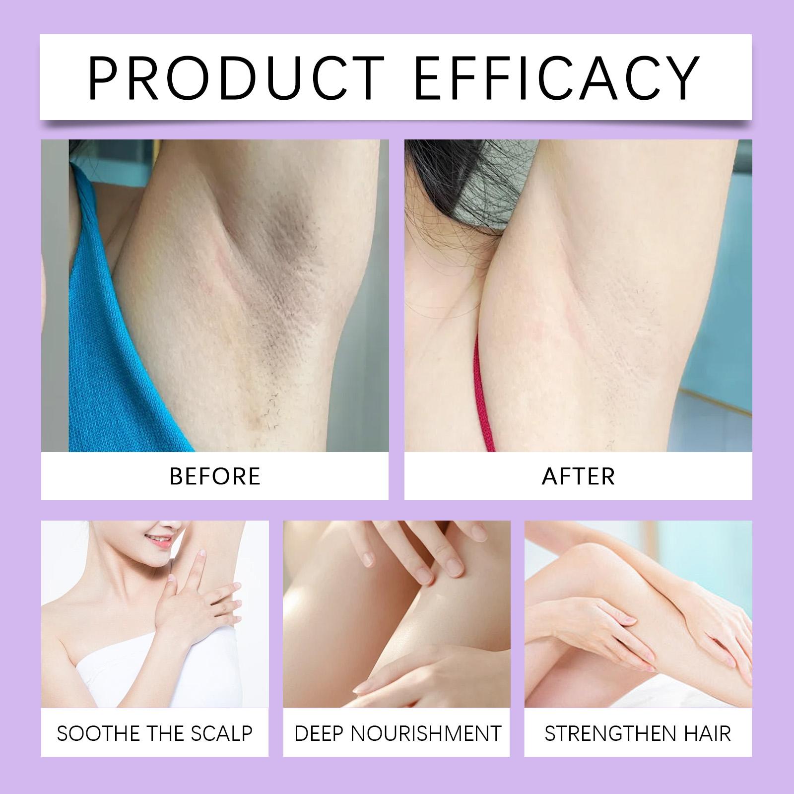 OceAura Cyperus Rotundus Oil for Hair Reduction - Natural Hair Growth Inhibitor & Strawberry Legs Treatment - Post-Hair Removal Skin Repair Serum with Vitamin E & Olive Oil - Soothing & Hydrating for Sensitive Skin - 2 fl oz