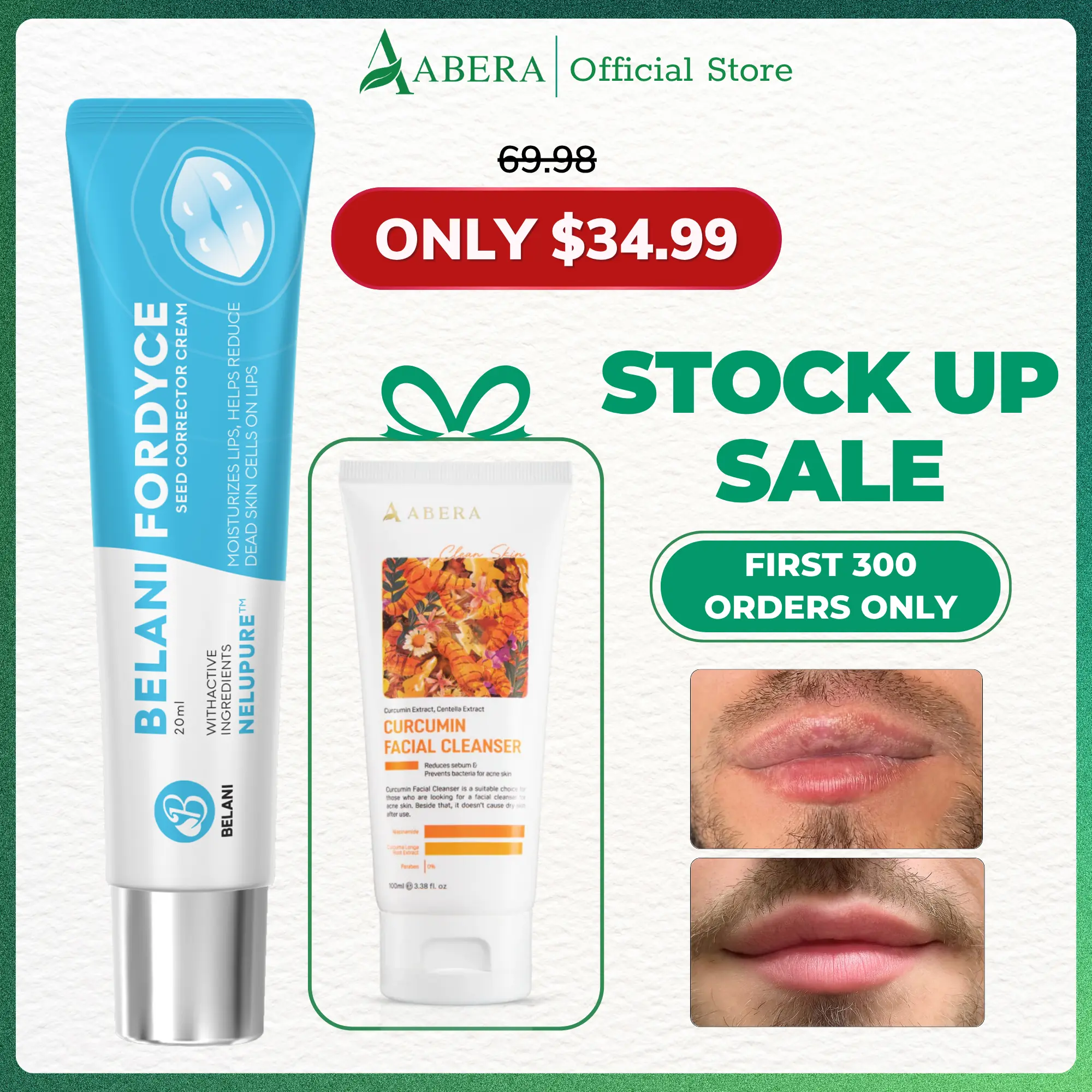 Belani Fordyce Cream - Fordyce Spot Care, Lip Moisturizer & Repair Balm for Men, Helps Improve Dark Lips, Enriched with  HPR & Activoil Spotless, 0.7 Oz (0.7 Oz)