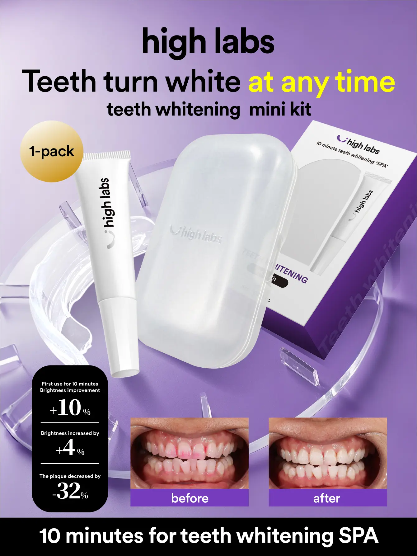 High Labs Teeth Whitening Strips Oral Mini Kit - 10 Minutes for Brighter Smile - 1-Pack SPA Treatment