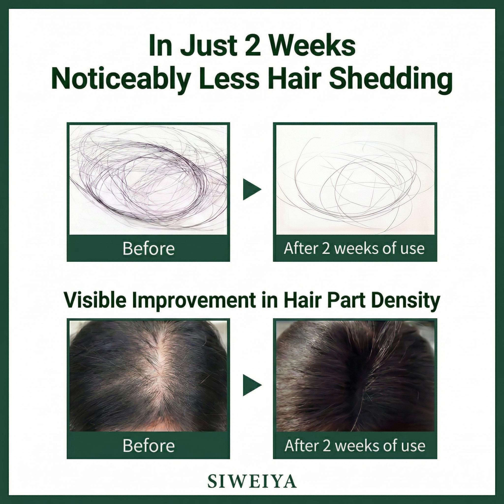 Korean Scalp Serum with Built-in Massager for Thinning Hair, Peptide Complex Formula Promotes Hair Volume, Strengthens Hair Roots, Soothes & Nourishes Scalp, Plant-Based Bio-Active Hair Care, 100 ml