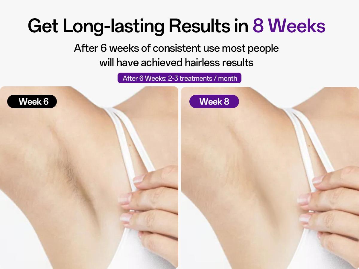 Laser Hair Removal Device for Women & Men, At-Home Painless IPL Laser Hair Remover with 40°F Ice-Cooling Contact, Long-Lasting Lazer Hair Removal for Face, Legs, Armpits, Bikini Line