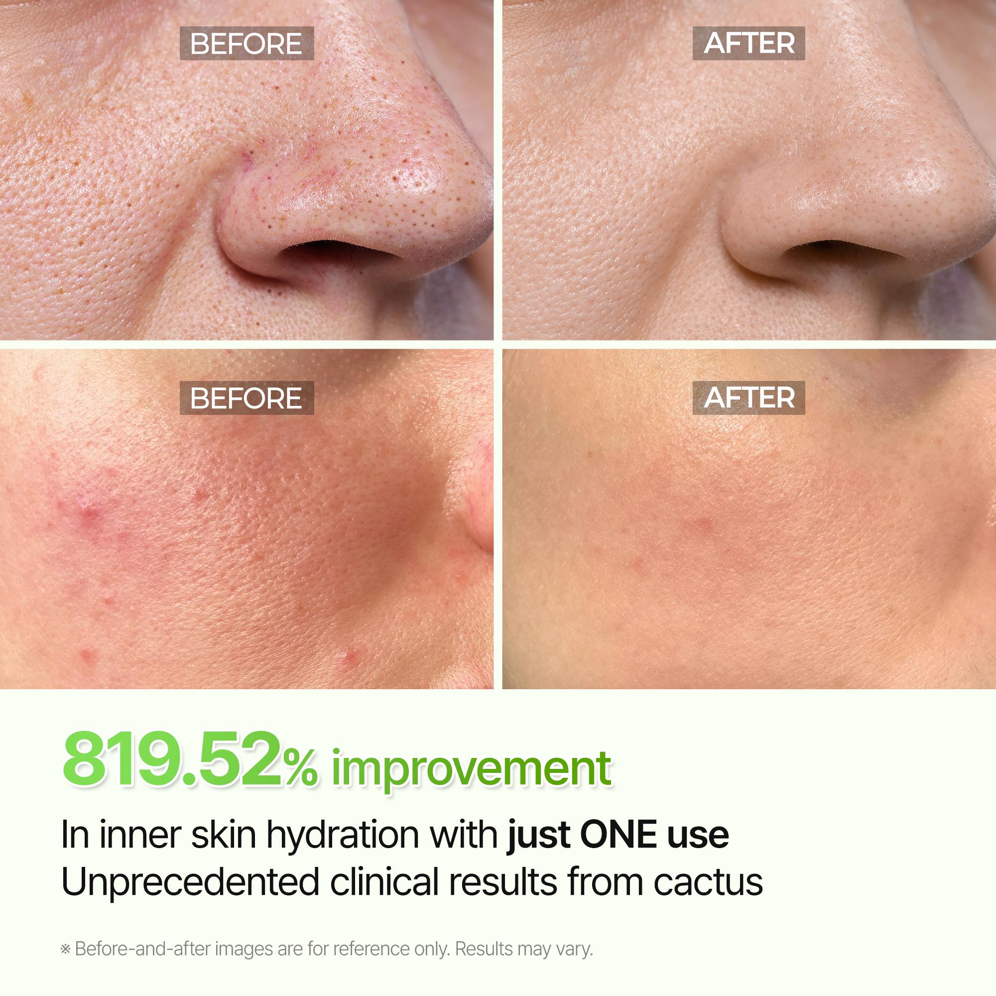 [Dr.Melaxin Official] CACTOX Pore Relief Jelly Toner Pads 60 Pads with Cactus Cooling & Dehydrated Pore Care