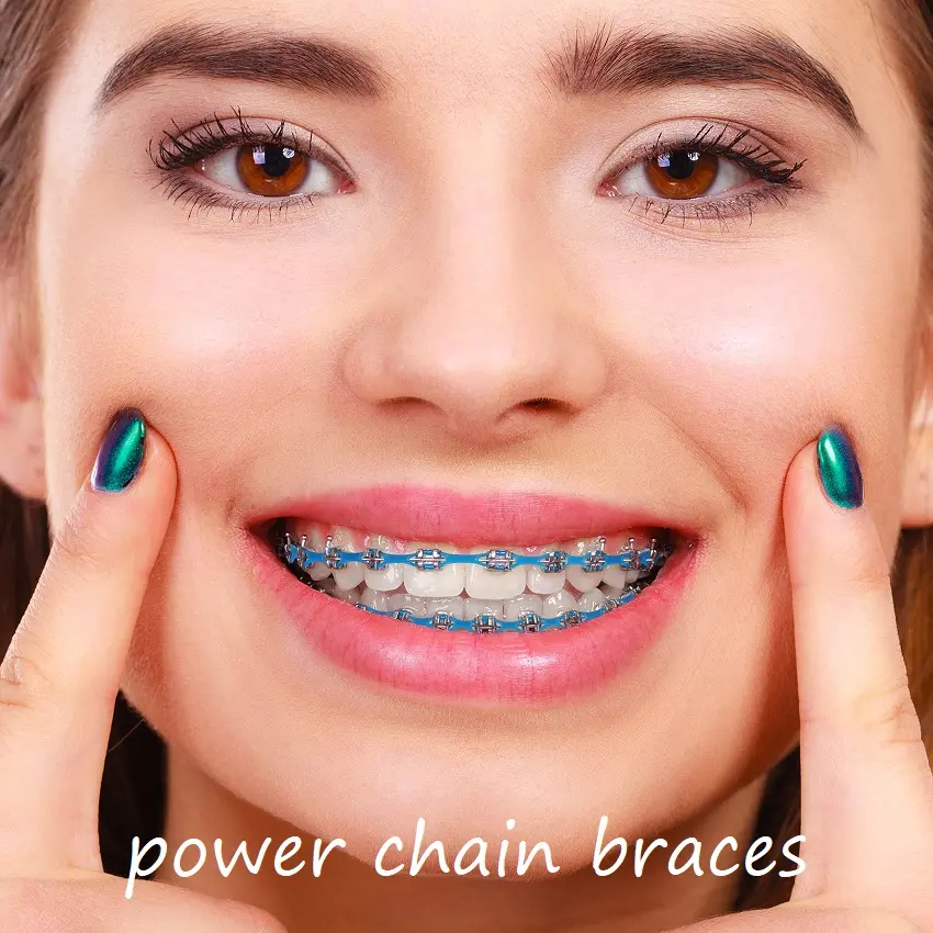 Braces Elastics Orthodontic Elastomeric Power Chain 15ft  High Elasticity Medical Grade Polyurethane Oral Healthcare Braces Elastics Superior Stability Made in USA
