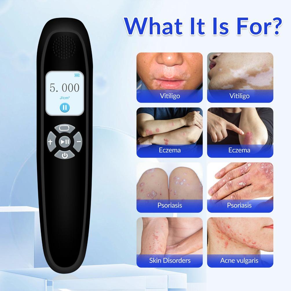 ZJZK 9 Diodes 308nm UVB Excimer Phototherapy Device, 65mW/cm² High Energy Density, Handheld Blue Light Skin Treatment, Targeted Therapy for Vitiligo, Psoriasis, Eczema, Atopic Dermatitis, Portable Home Use for Skin Disorders