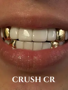 CRUSH CR 14K Gold Plated Solid Single Tooth Cap Set for Men Women, Unisex, SHypoallergenic Removable, for Hip Hop Concerts, Streetwear Fits, Club Nights, Durable Tarnish-Resistant Plating, Subtle Bling Dental Jewelry, Golden Color