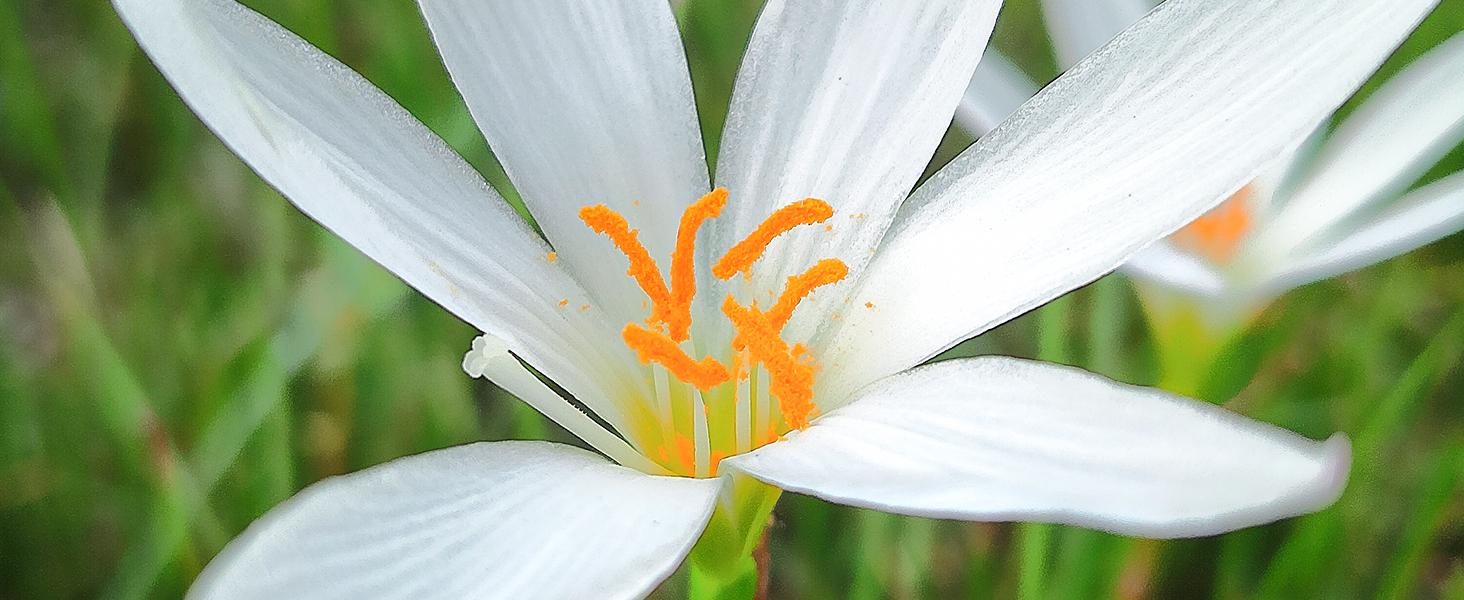 MicroCam X1 Mini Microscope Camera 400X – See Skin, Bugs & Hidden Details in 4K | Pocket Digital Microscope MicroCam X1 Mini Microscope Camera 400X – See Skin, Bugs & Hidden Details in 4K | Pocket Digital Microscope