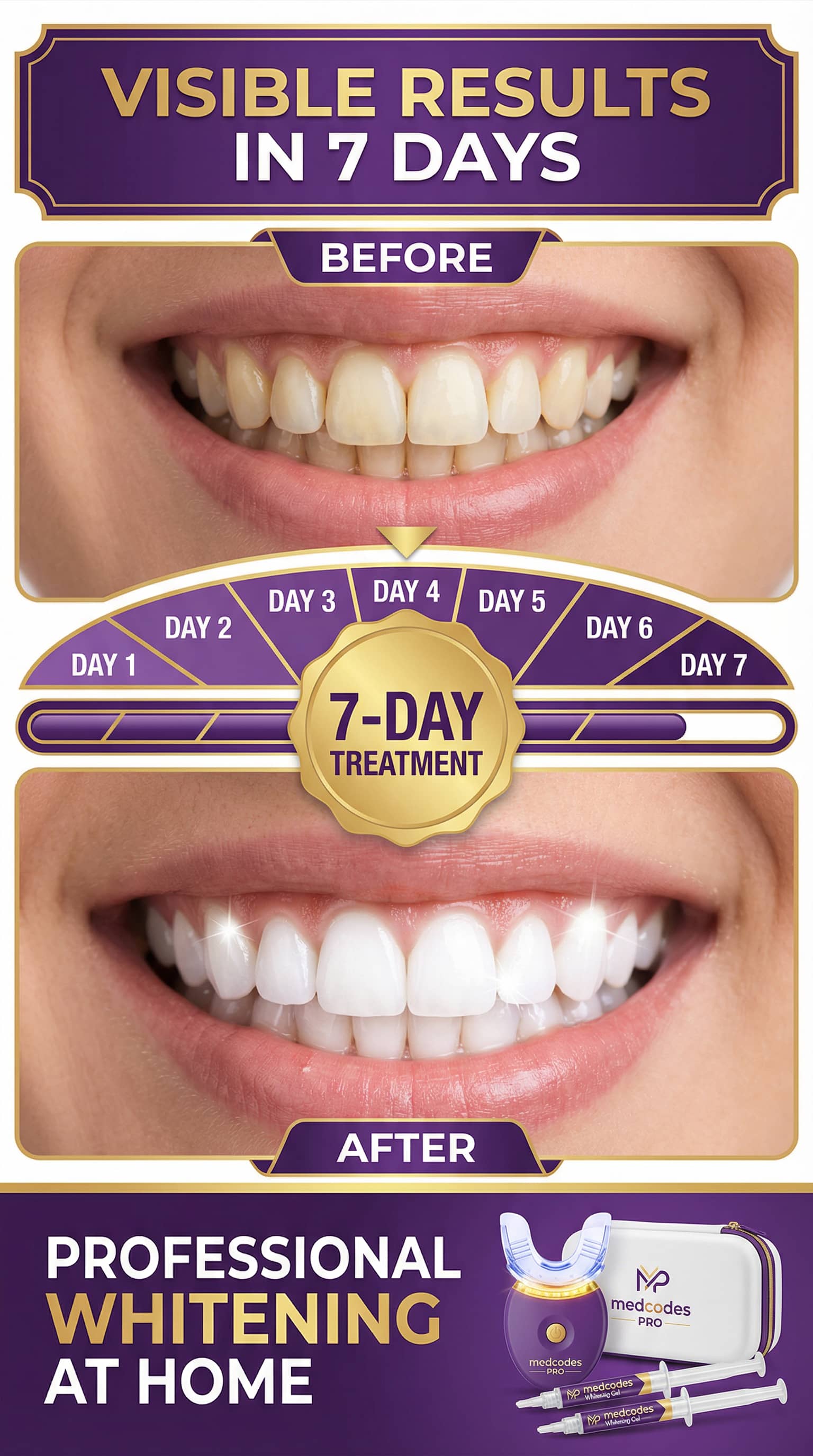 medcodes PRO Professional Teeth Whitening Strips | Elastic Stretch Technology | 360° Coverage | High Adhesion | Gentle Non-Irritating Formula | 7 Applications