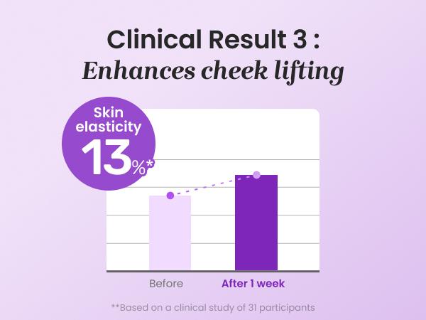 PDRN Active Boost Face Serum - Salmon DNA Serum for Face, Smoothing Fine Lines & Wrinkle, Rejuvenating & Firming Skin, Anti-aging Booster with Collagen, Korean Skin Care, 1.01 fl. oz. (30ml)