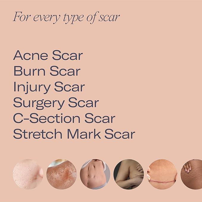 ESTAS Daily Dose Scar Cream Serum - Lightweight Hydrating Moisturizer with Hyaluronic Acid & Vitamin E for Smoother Skin Repair & Visible Results - Moisturizing