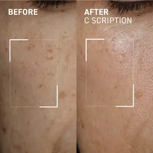 C Scription - Fast - Absorbing Vitamin C Brightening Serum - Enriched with Oxiblock SF, a potent antioxidant complex/