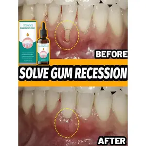 Rapid Repair Gums Serum Effectively Relieve Tooth Allergy Dental Caries Tooth Cleaning Toothpaste Relieve Tooth Damage Drops