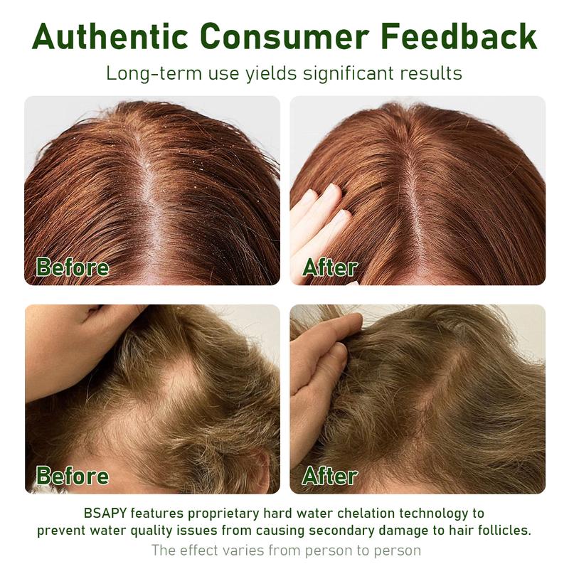 BSAPY Anti Hair Loss Shampoo Bar 120g DHT Blocker with Polygonum Ginseng & Tea Tree Strengthens Roots Reduces Hair Fall Sulfate-Free Herbal Hair Growth Soap HR