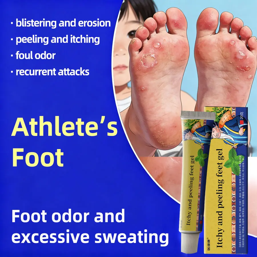 Herbal anti-itch cream for athlete's foot. Quickly relieves foot itch, odor, peeling and chaps, removes foot odor, gently repairs feet, ideal for the whole family.