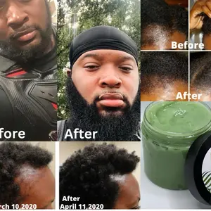 Superior growth grease, all natural hair grease,aloe Vera hair grease, hair growth grease, hair moisturizer, hair growth, thick hair Anti-dandruff Organic