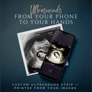 Custom Traditional Ultrasound Print - Upload Your Images for Personal Keepsake & Baby Announcements