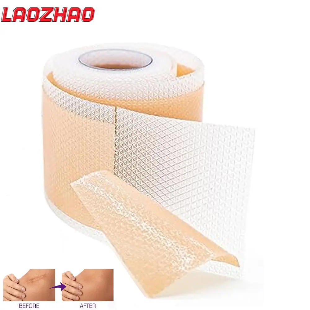 1 Roll Silicone Scar Sheets - Medical Grade, Reusable Scar Tape for Keloid, C-Section, Surgery, Burn, Acne - Waterproof, Latex-F