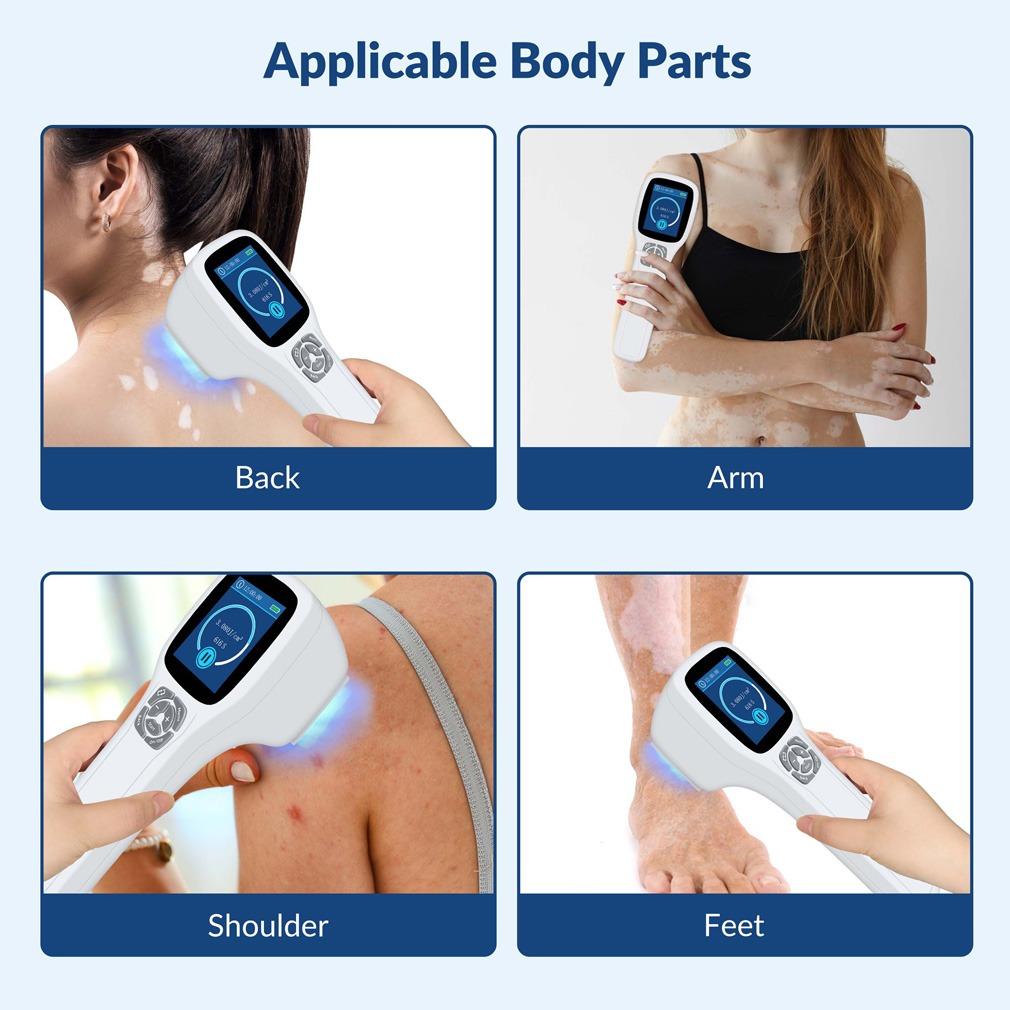 ZJZK 308nm Excimer Phototherapy Device with 64 Diodes, Blue Light Therapy for Vitiligo, Psoriasis, Eczema, Atopic Dermatitis, Fungal Skin Disease, Hypopigmentation, Safe Targeted Home Use, Fast Recovery, Prevent Recurrence, Portable Handheld