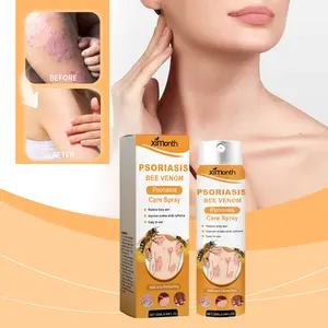 XIMONTH Bee Venom Psoriasis Care Spray - Deep - Penetrating, Soothing & Effective for Skin Recovery Eliminate Scales, Relieve Itching & Restore Skin Healthcare Natural