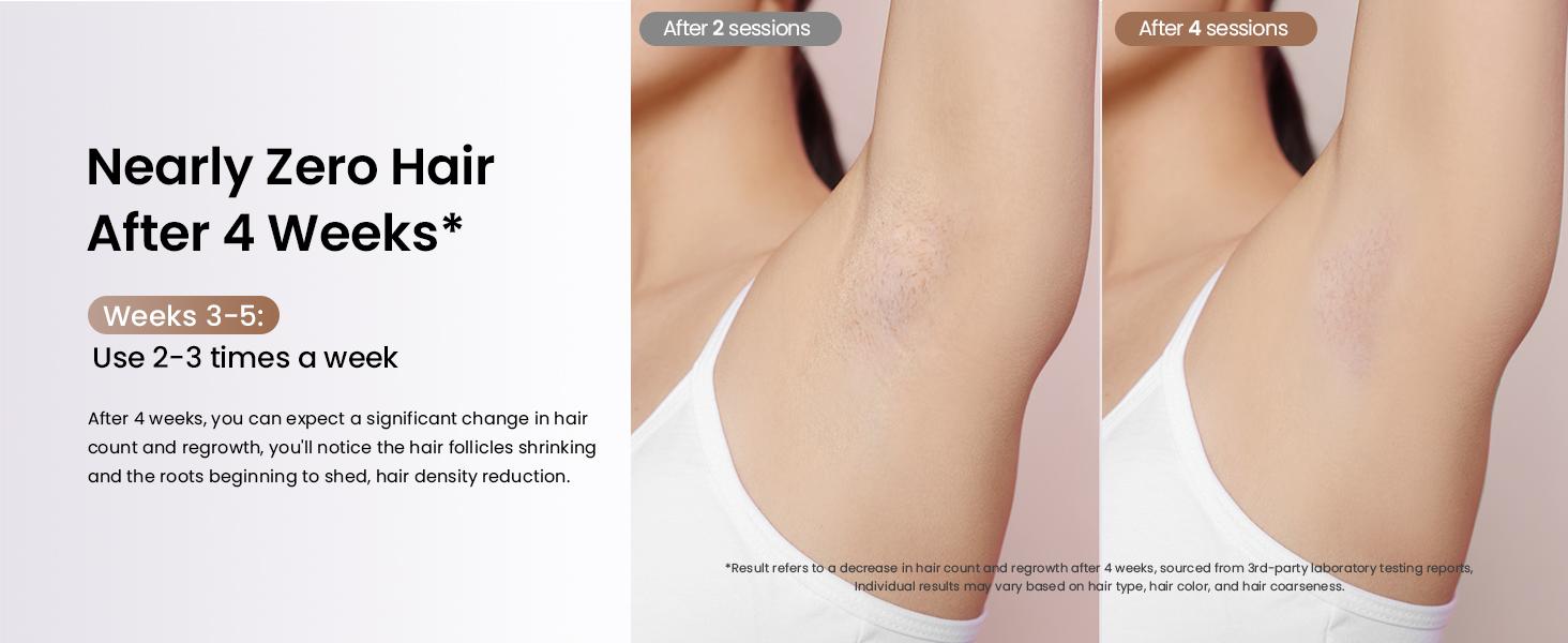 Laser Hair Removal Ice Cooling, Painless IPL Laser Hair Removal Device At-Home Permanent ipl device Portable IPL Smooth Comfort IPL Hair hair remival