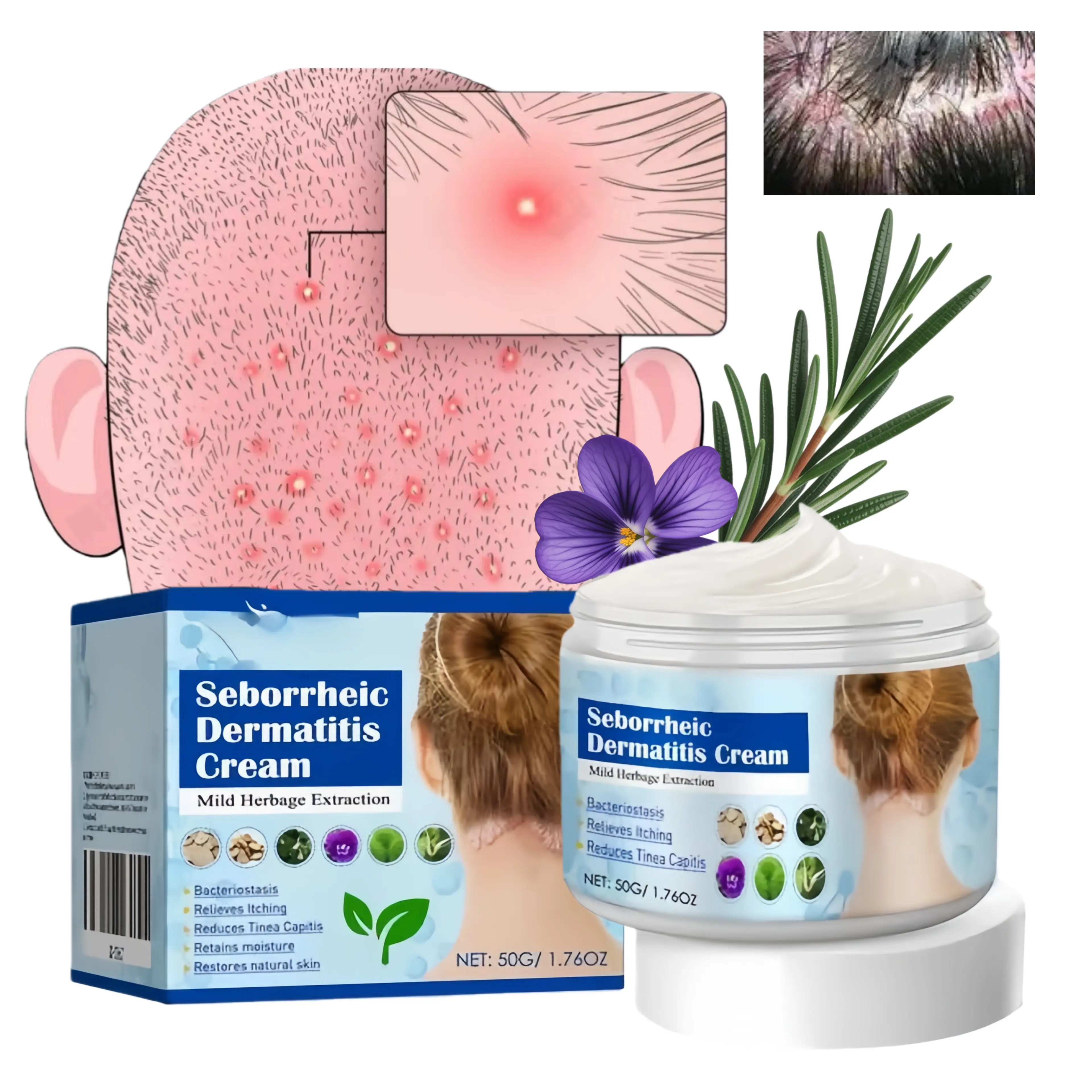 Folliculitis Treatment Cream-Natural Herbal Formula withHoneysuckle, Dandelion, Sophora & Phellodendron for ScalpFace & Body Care, Soothing & Repairing 50g, SeborrheicDermatitis Cream