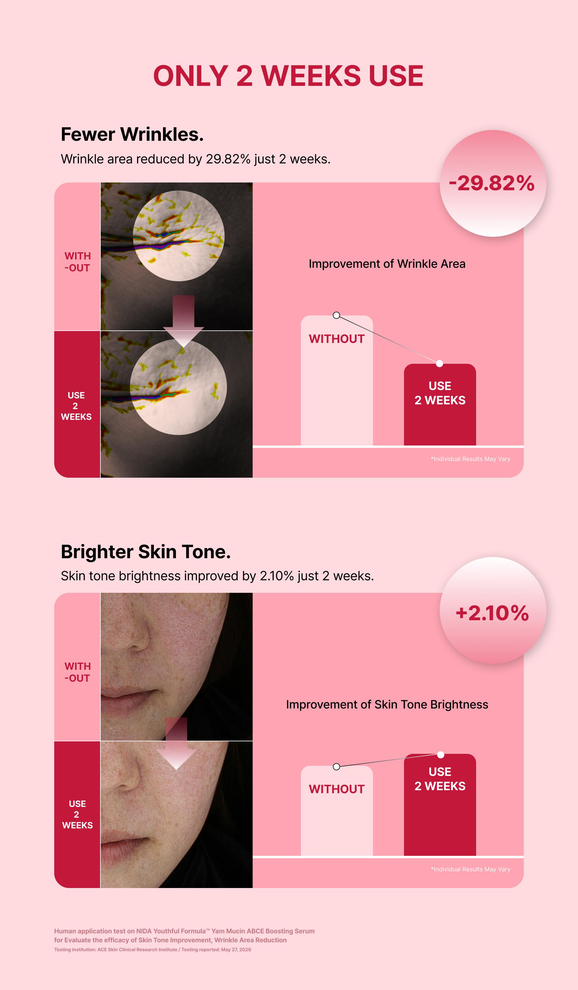 NIDA Yam Mucin ABCE Boosting Bundle