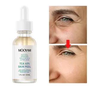 Instant Radiance Peel: TCA 40% Skin Peel for Youthful Glow Skincare Exfoliant Gentle Skin Repair Comfort